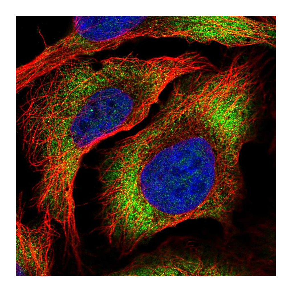 Atlas Antibodies Anti-ZC3HAV1L Antibody