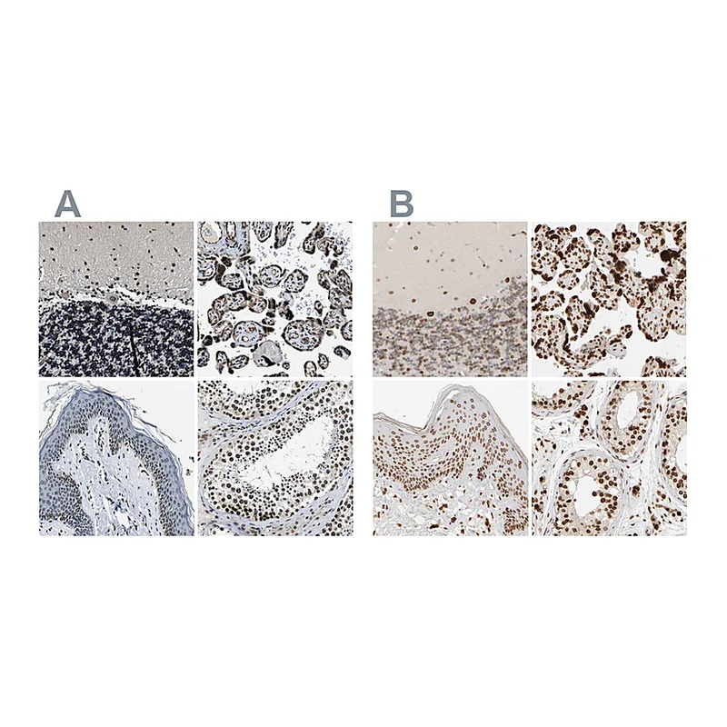 Atlas Antibodies Anti-ZC3HC1 Antibody