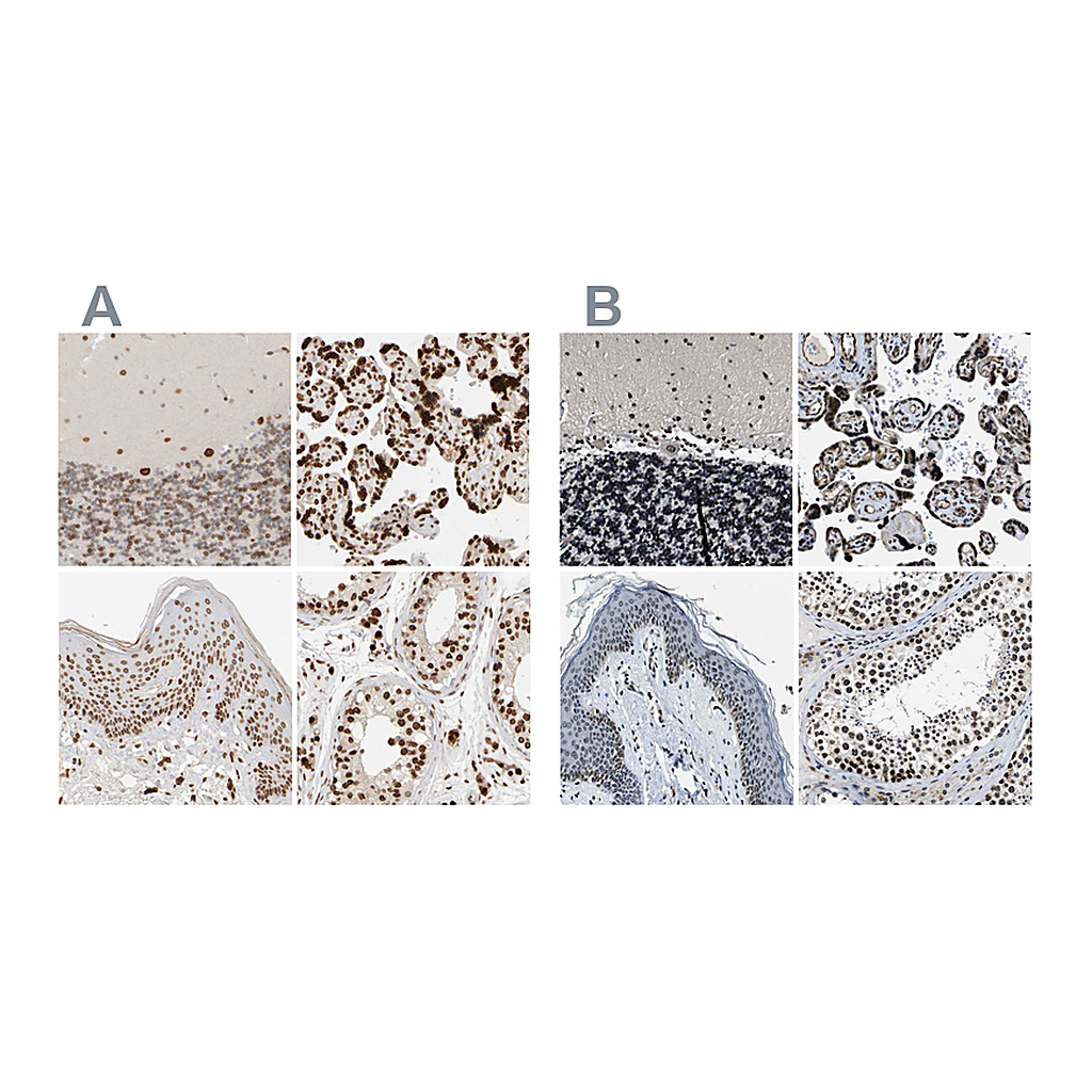 Atlas Antibodies Anti-ZC3HC1 Antibody