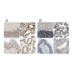 Atlas Antibodies Anti-ZC3HC1 Antibody