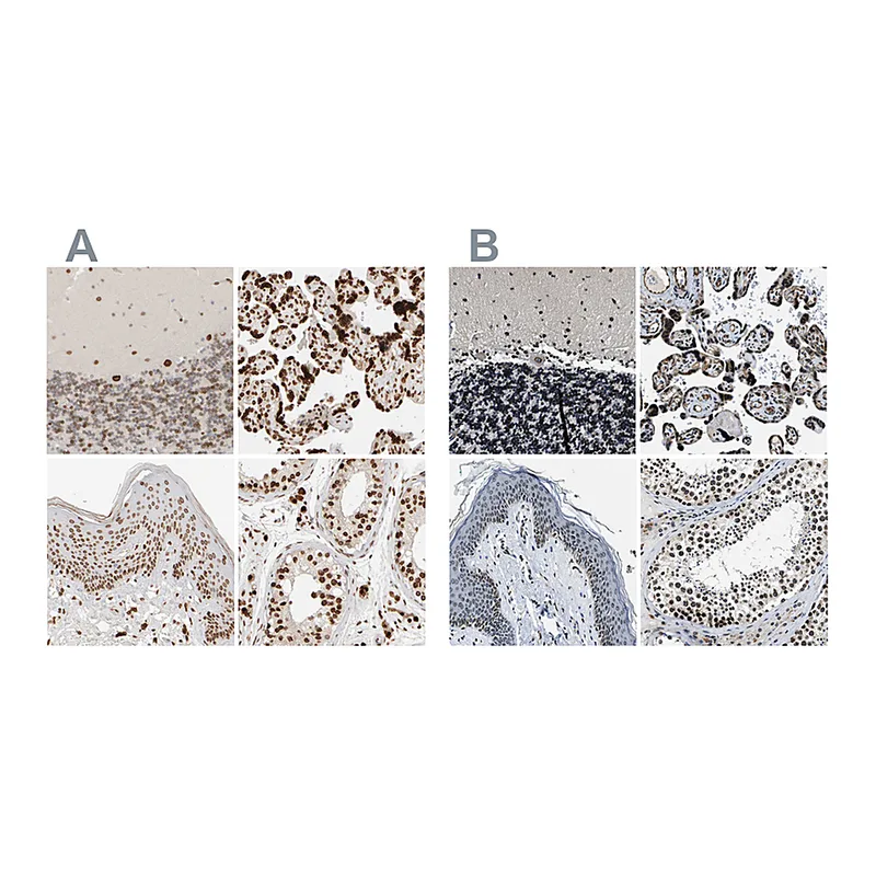 Atlas Antibodies Anti-ZC3HC1 Antibody