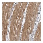 Atlas Antibodies Anti-ZCCHC11 Antibody
