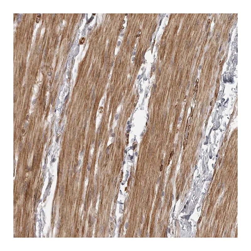 Atlas Antibodies Anti-ZCCHC11 Antibody