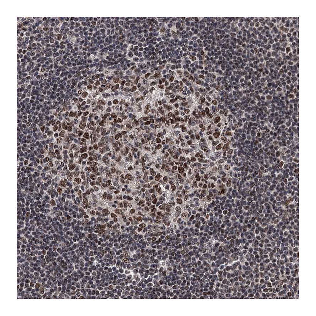 Atlas Antibodies Anti-ZCCHC10 Antibody