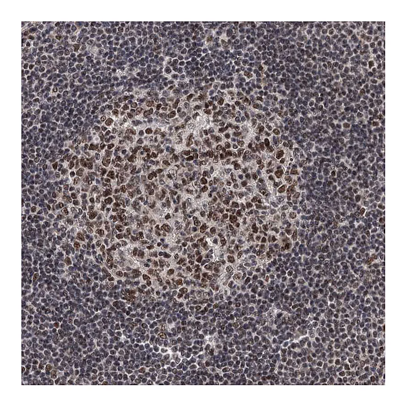 Atlas Antibodies Anti-ZCCHC10 Antibody