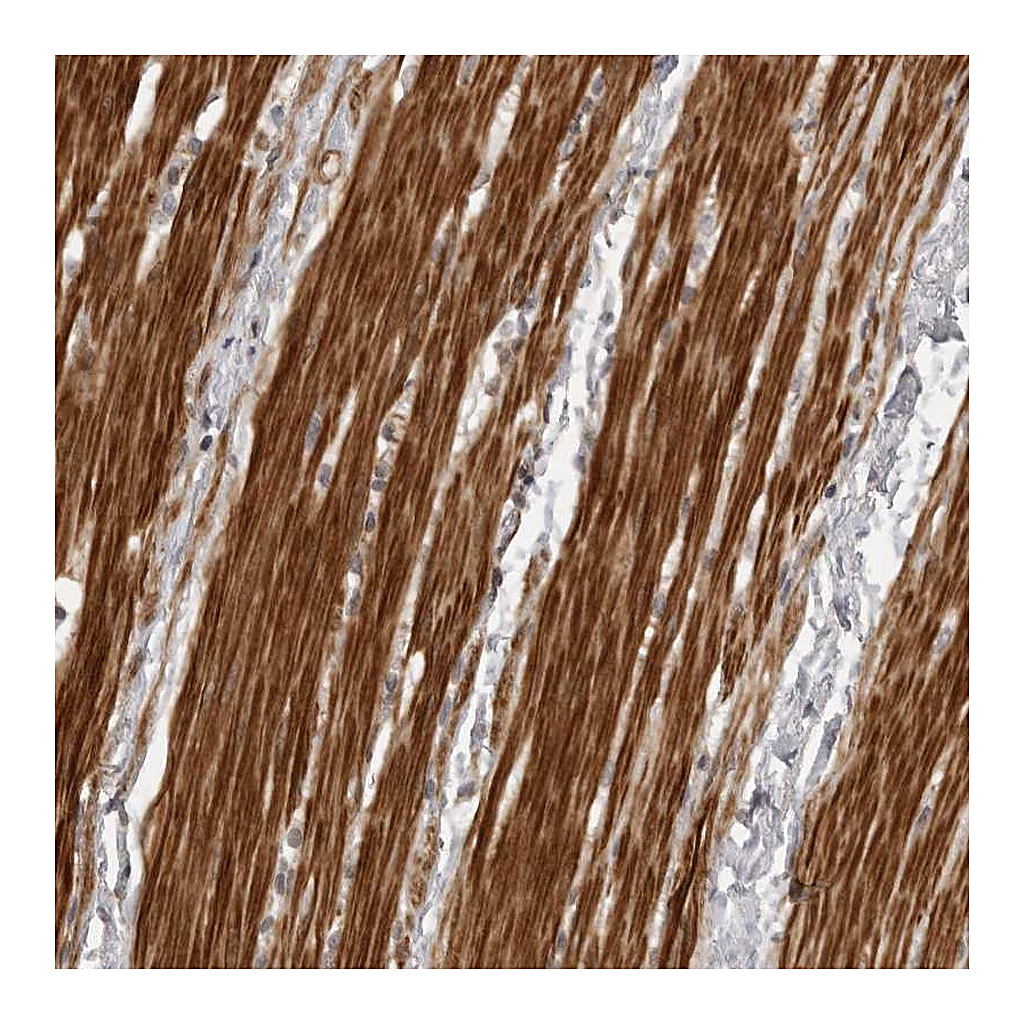 Atlas Antibodies Anti-ZCCHC11 Antibody