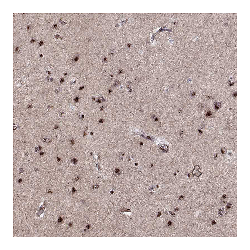 Atlas Antibodies Anti-ZCCHC17 Antibody