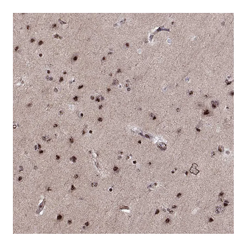 Atlas Antibodies Anti-ZCCHC17 Antibody