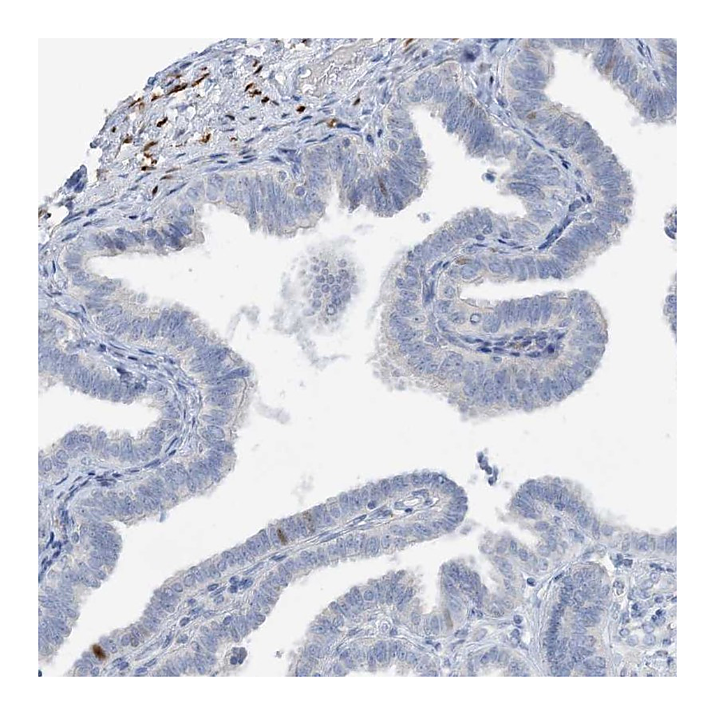 Atlas Antibodies Anti-ZCCHC12 Antibody