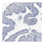 Atlas Antibodies Anti-ZCCHC12 Antibody