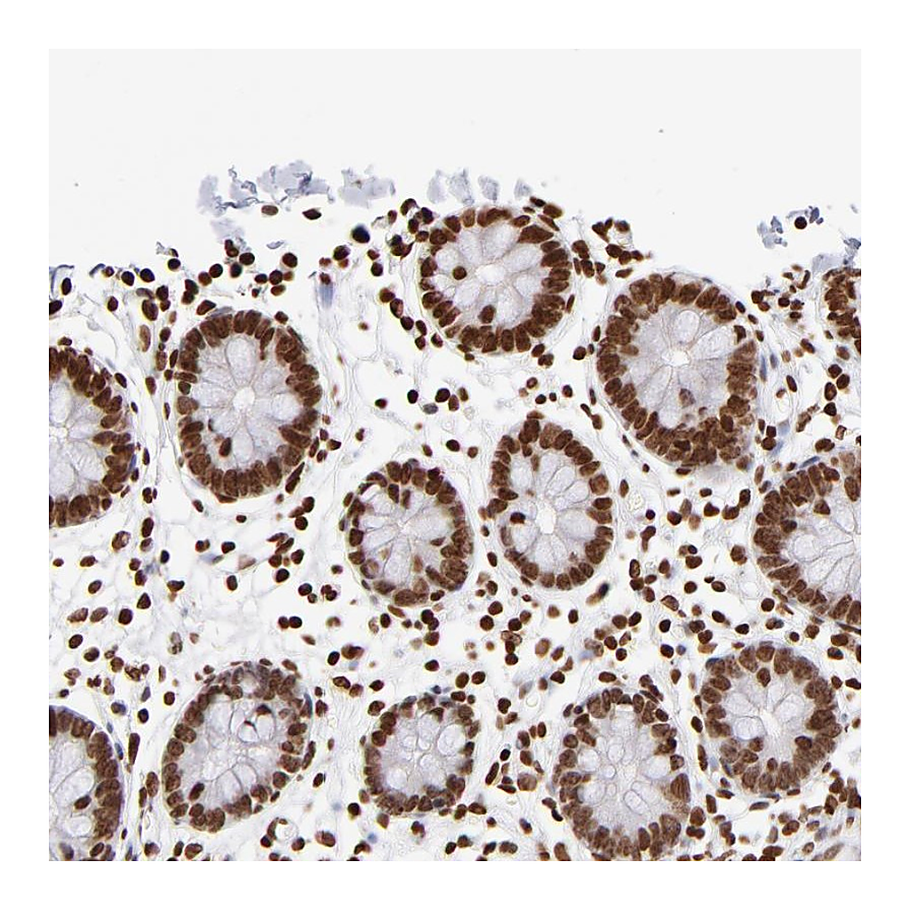 Atlas Antibodies Anti-ZCCHC16 Antibody