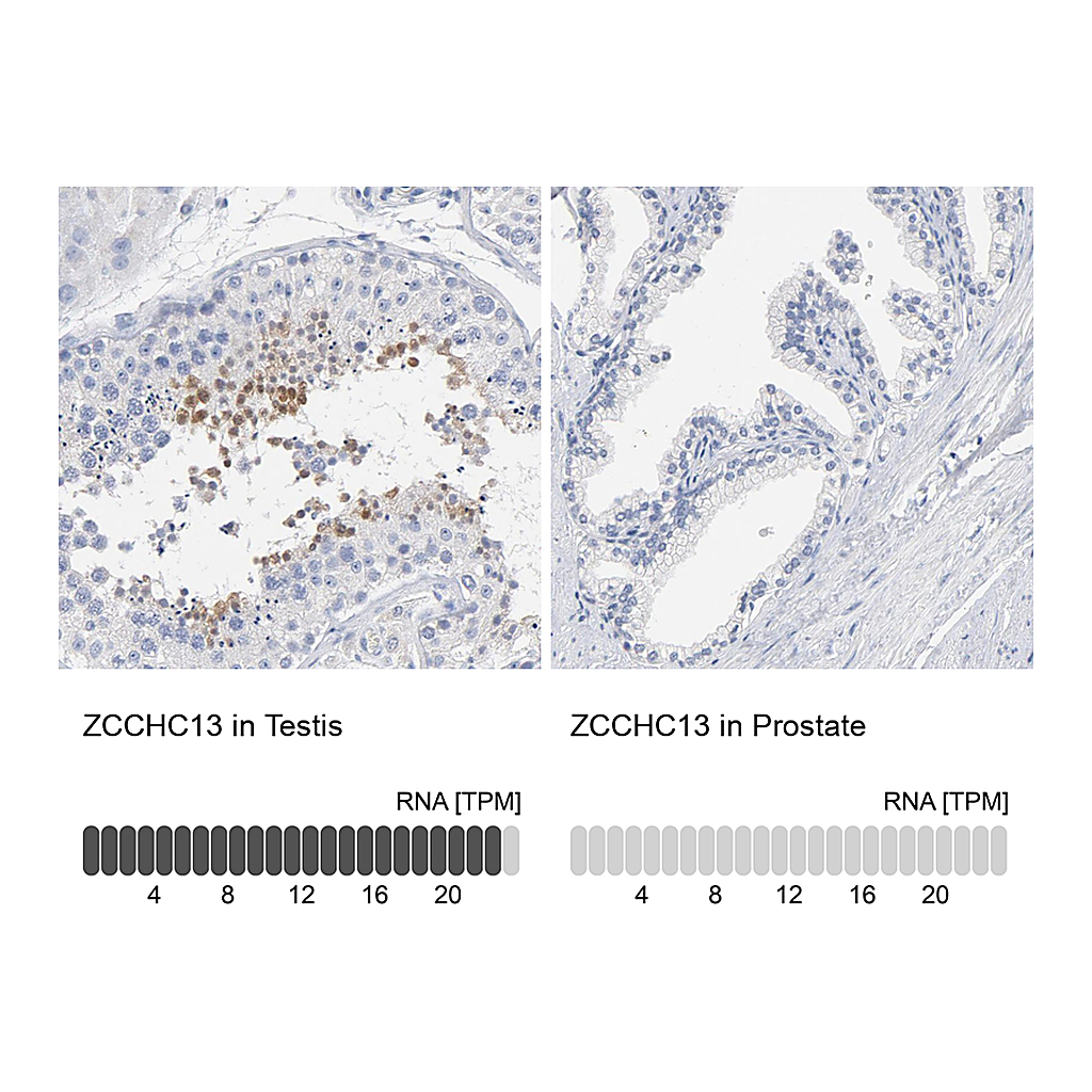 Atlas Antibodies Anti-ZCCHC13 Antibody
