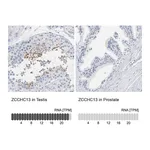 Atlas Antibodies Anti-ZCCHC13 Antibody