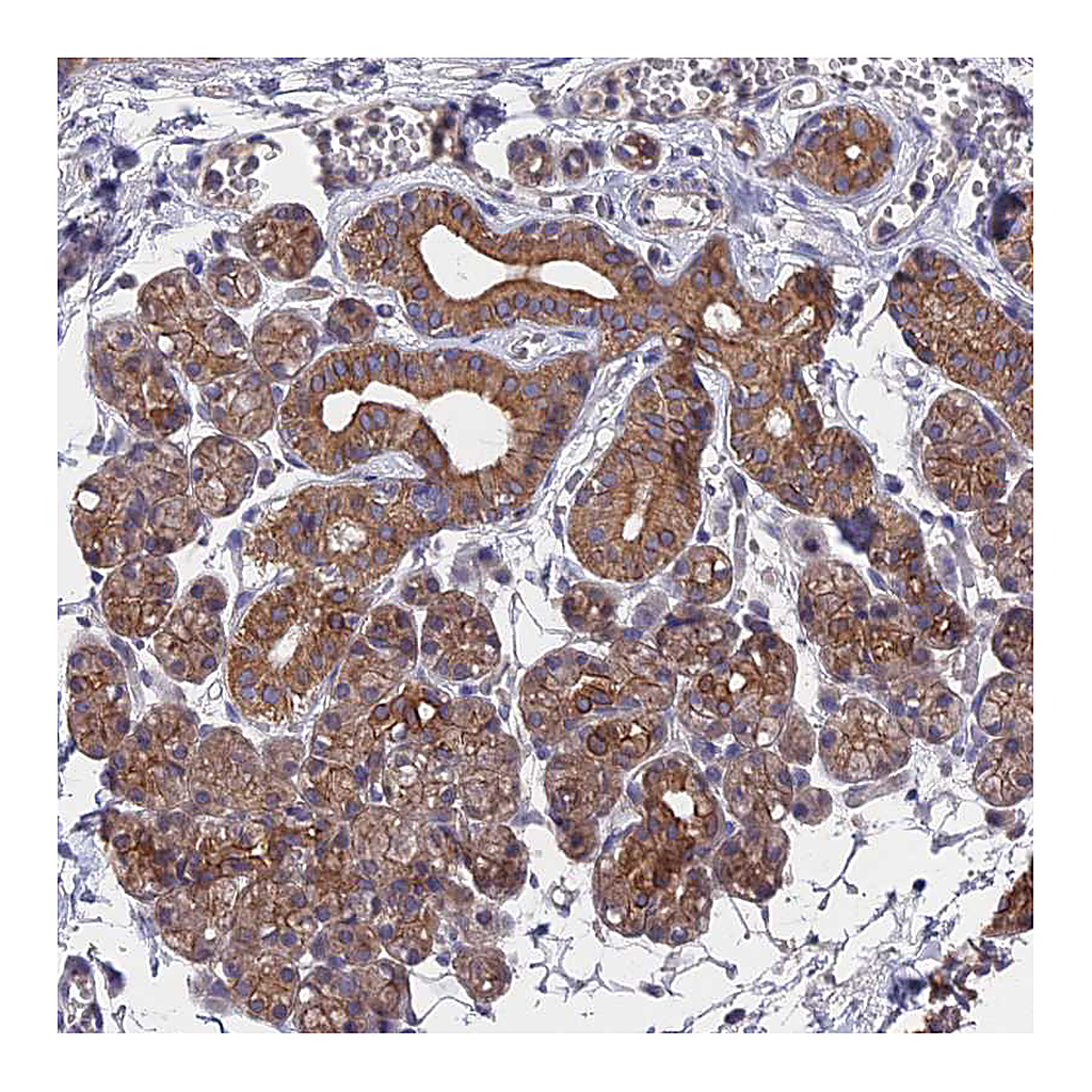 Atlas Antibodies Anti-ZCCHC2 Antibody