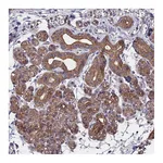 Atlas Antibodies Anti-ZCCHC2 Antibody