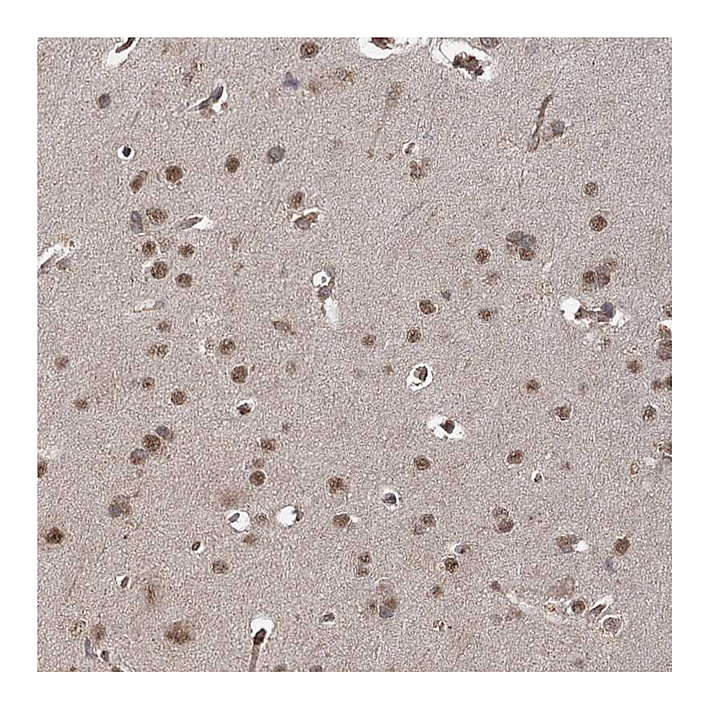 Atlas Antibodies Anti-ZCCHC24 Antibody