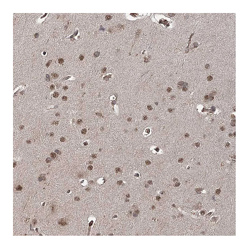 Atlas Antibodies Anti-ZCCHC24 Antibody