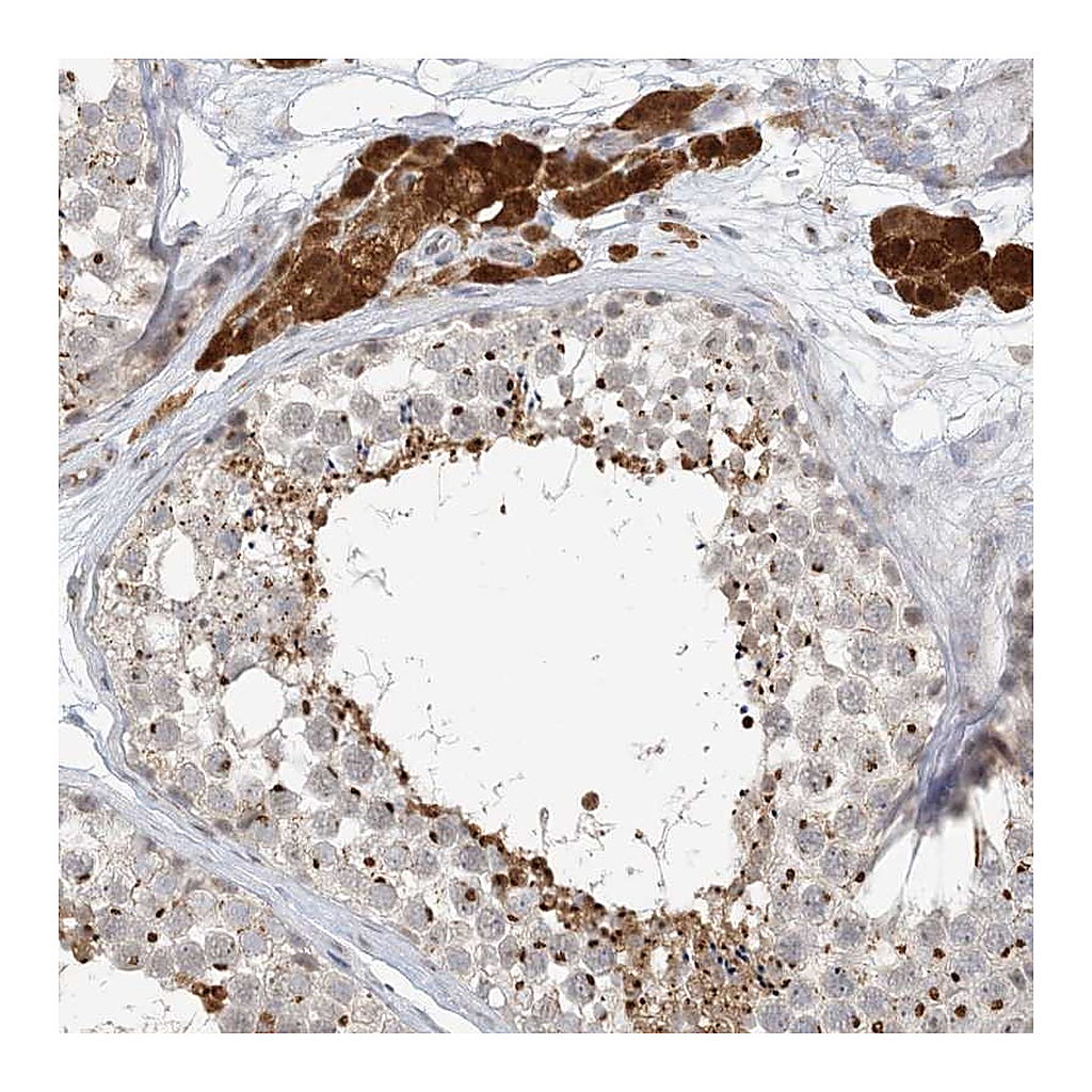 Atlas Antibodies Anti-ZCCHC4 Antibody