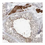 Atlas Antibodies Anti-ZCCHC4 Antibody