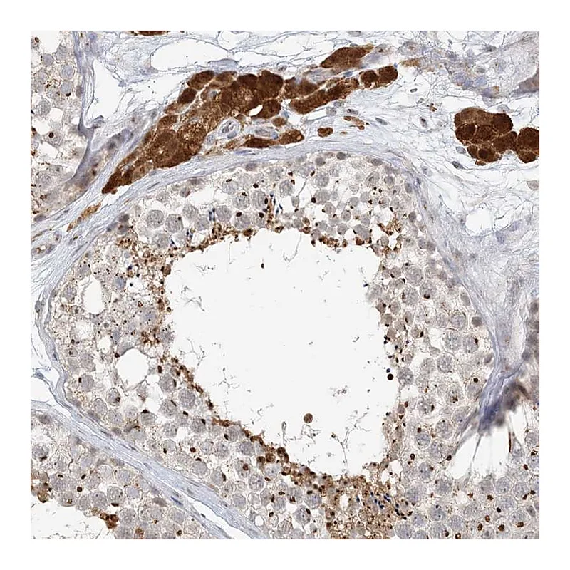 Atlas Antibodies Anti-ZCCHC4 Antibody