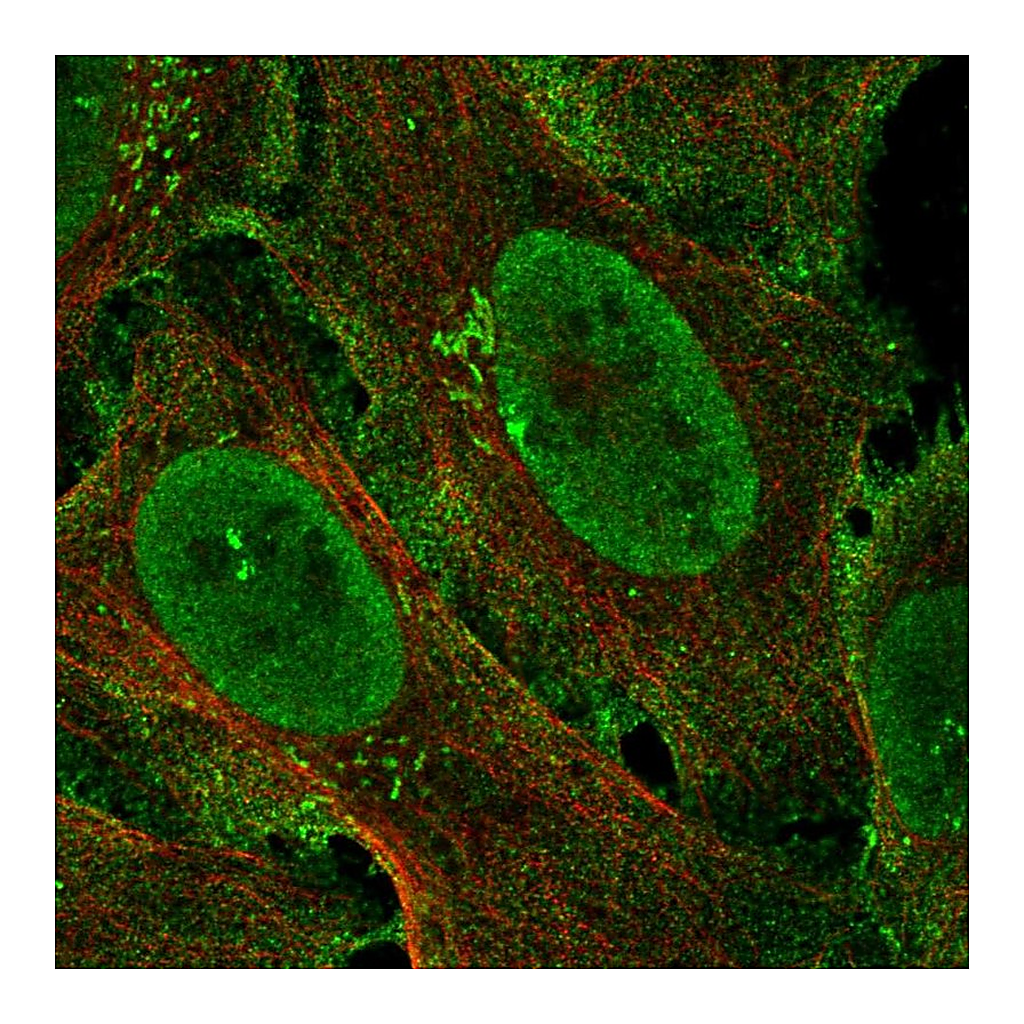 Atlas Antibodies Anti-ZCCHC5 Antibody