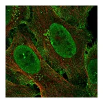 Atlas Antibodies Anti-ZCCHC5 Antibody
