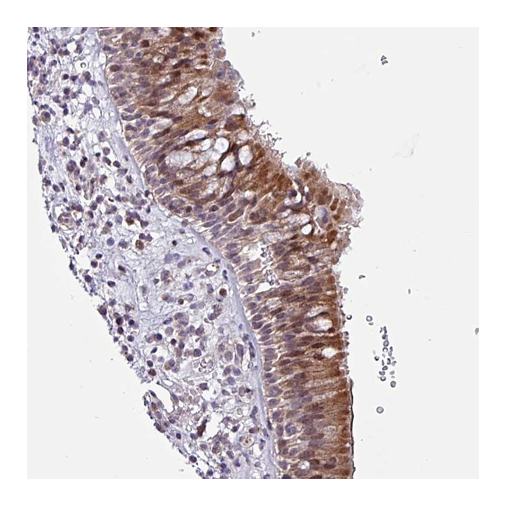 Atlas Antibodies Anti-ZCCHC5 Antibody