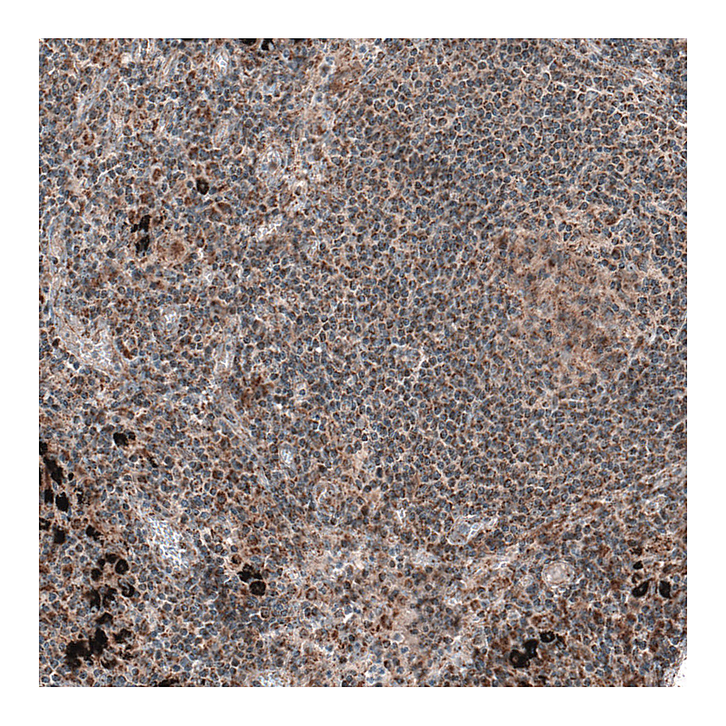 Atlas Antibodies Anti-ZCCHC7 Antibody