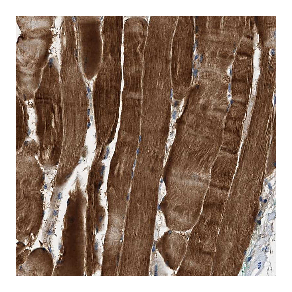 Atlas Antibodies Anti-ZCCHC6 Antibody