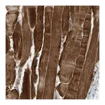 Atlas Antibodies Anti-ZCCHC6 Antibody