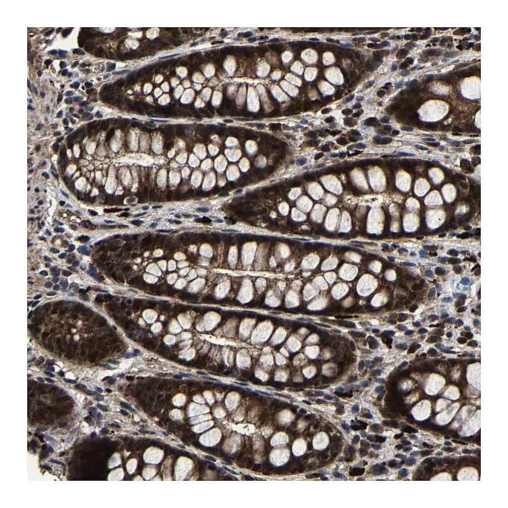 Atlas Antibodies Anti-ZCCHC7 Antibody