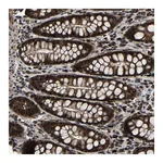 Atlas Antibodies Anti-ZCCHC7 Antibody