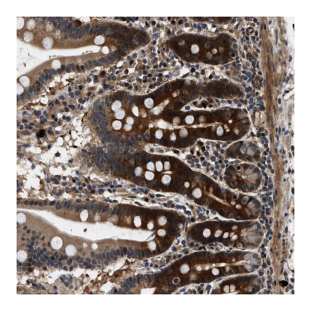 Atlas Antibodies Anti-ZCCHC6 Antibody
