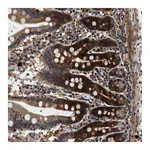 Atlas Antibodies Anti-ZCCHC6 Antibody