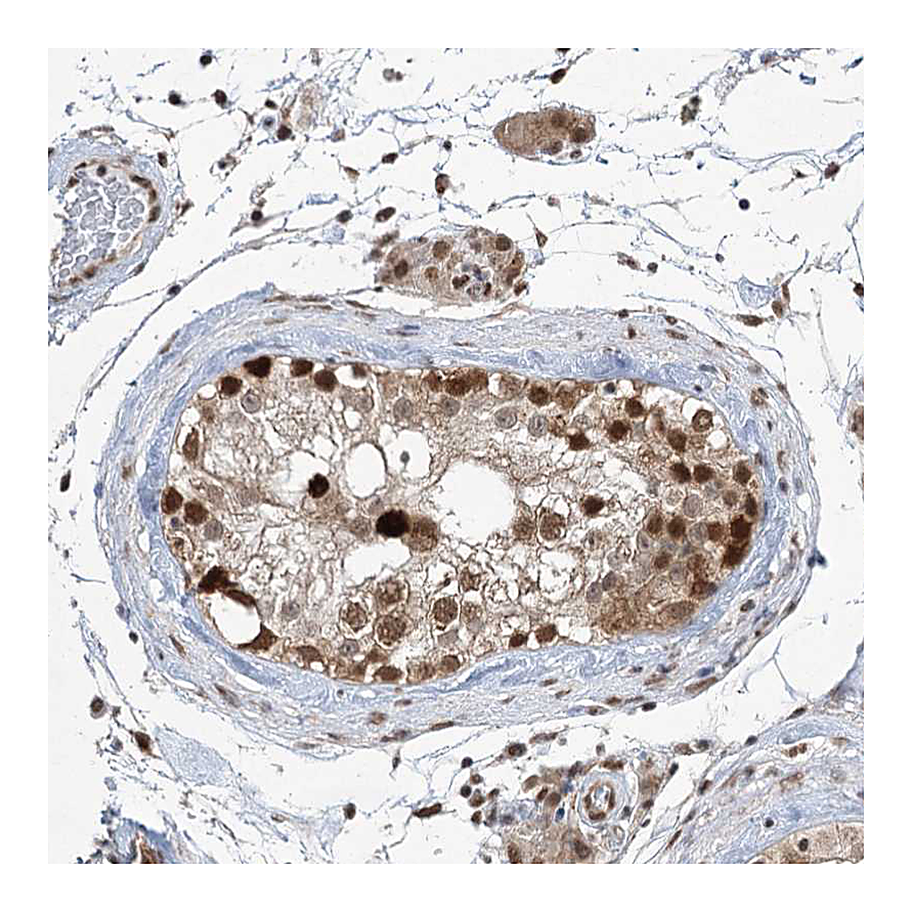 Atlas Antibodies Anti-ZCCHC8 Antibody