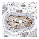 Atlas Antibodies Anti-ZCCHC8 Antibody