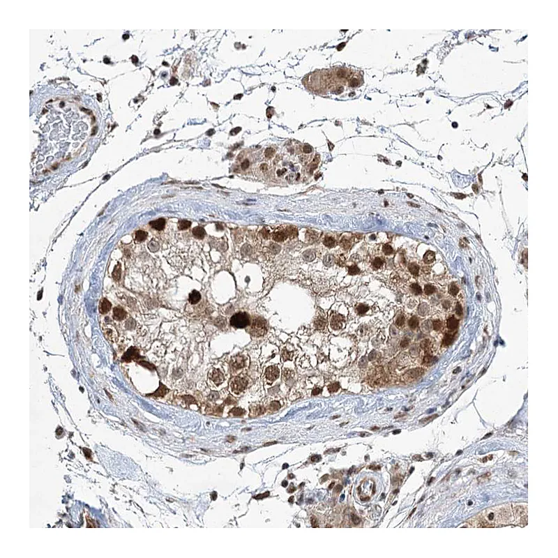 Atlas Antibodies Anti-ZCCHC8 Antibody