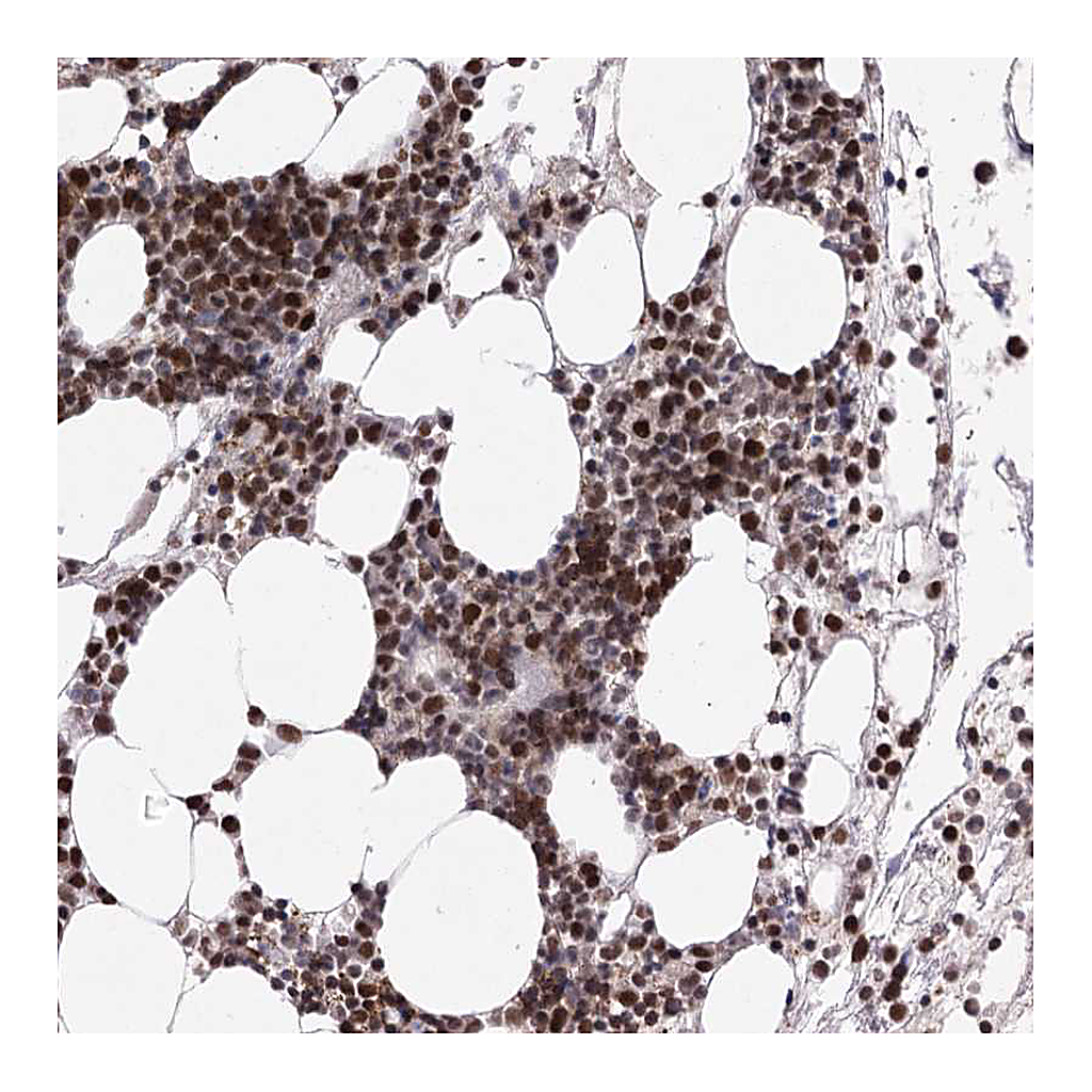 Atlas Antibodies Anti-ZCCHC8 Antibody