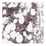 Atlas Antibodies Anti-ZCCHC8 Antibody