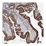 Atlas Antibodies Anti-ZCCHC9 Antibody