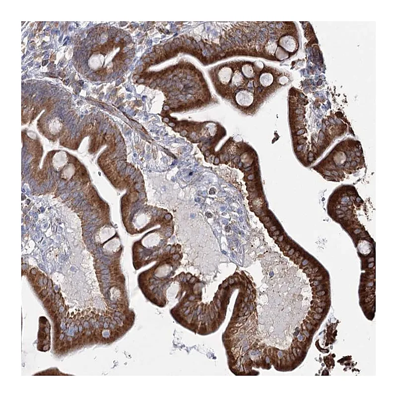 Atlas Antibodies Anti-ZCCHC9 Antibody