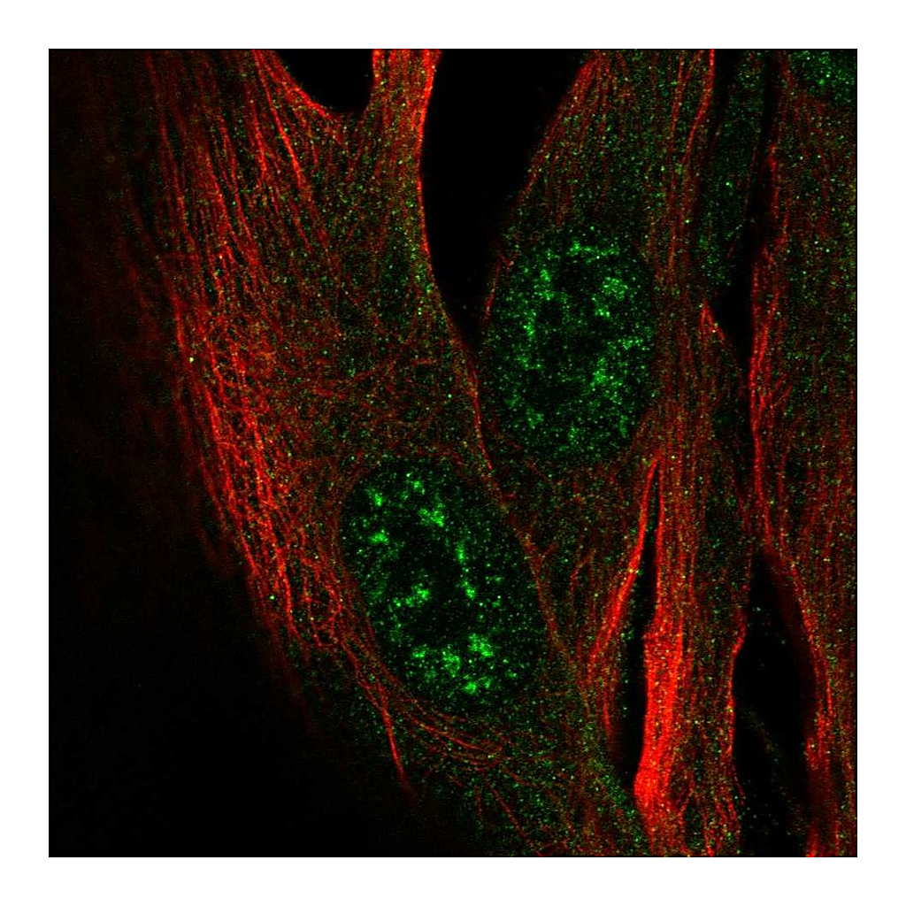 Atlas Antibodies Anti-ZCWPW2 Antibody