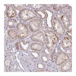 Atlas Antibodies Anti-ZDHHC1 Antibody