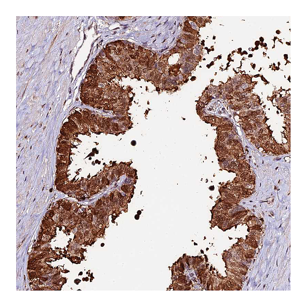 Atlas Antibodies Anti-ZDBF2 Antibody