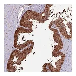 Atlas Antibodies Anti-ZDBF2 Antibody