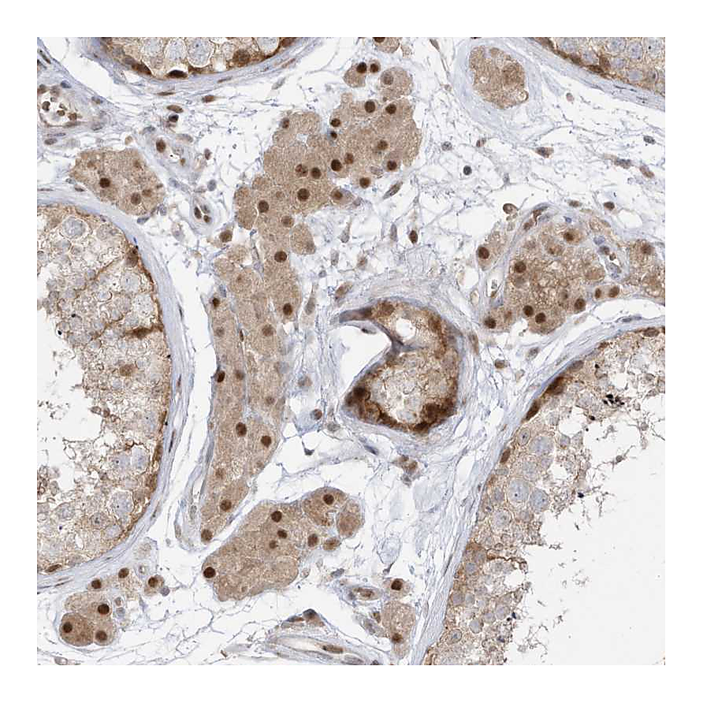 Atlas Antibodies Anti-ZCWPW2 Antibody