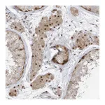 Atlas Antibodies Anti-ZCWPW2 Antibody