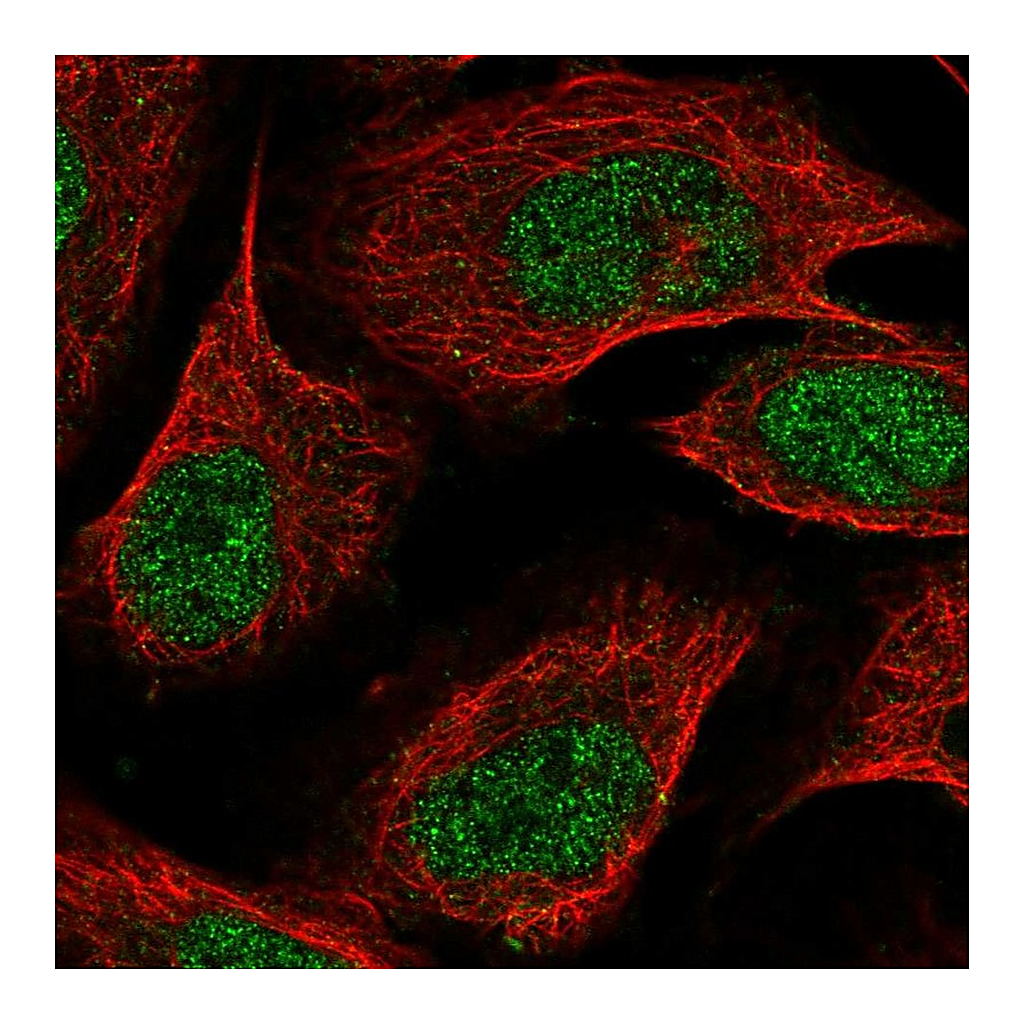 Atlas Antibodies Anti-ZDBF2 Antibody