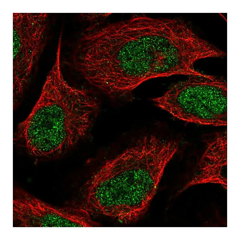 Atlas Antibodies Anti-ZDBF2 Antibody