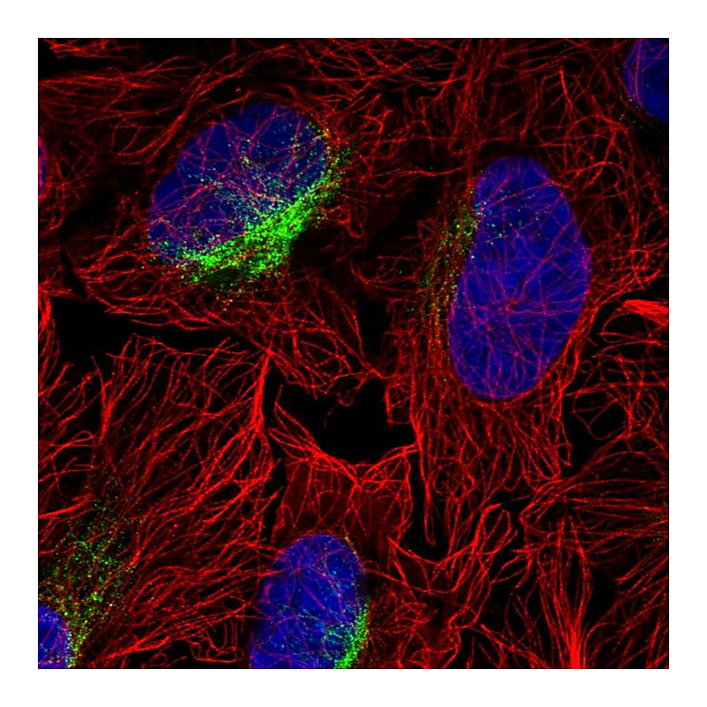 Atlas Antibodies Anti-ZCCHC9 Antibody